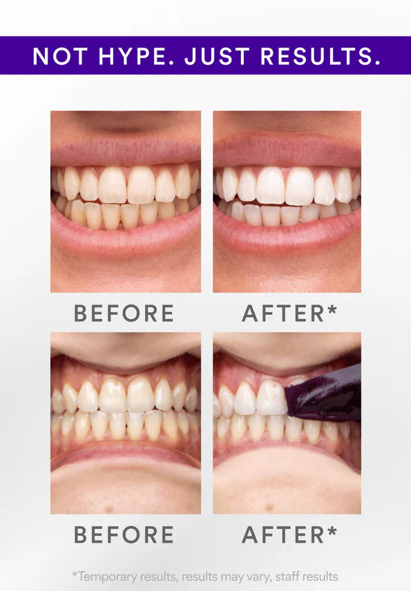 V34 Whitening Strips (7 Pack)