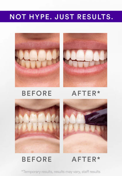 V34 Whitening Strips (7 Pack)