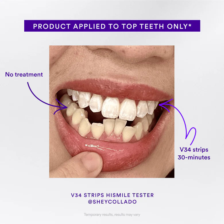 V34 Whitening Strips (7 Pack)