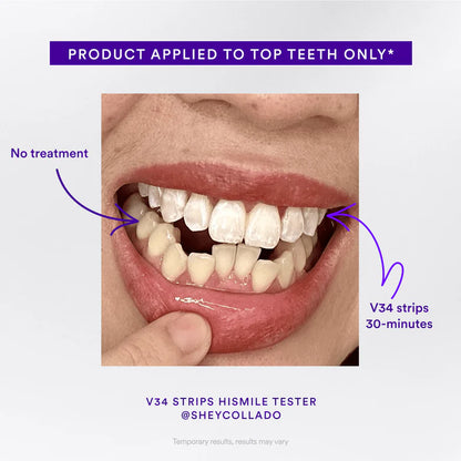 V34 Whitening Strips (7 Pack)
