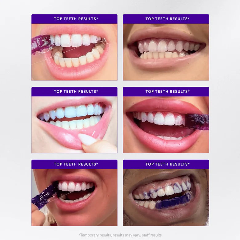 V34 Whitening Strips (7 Pack)