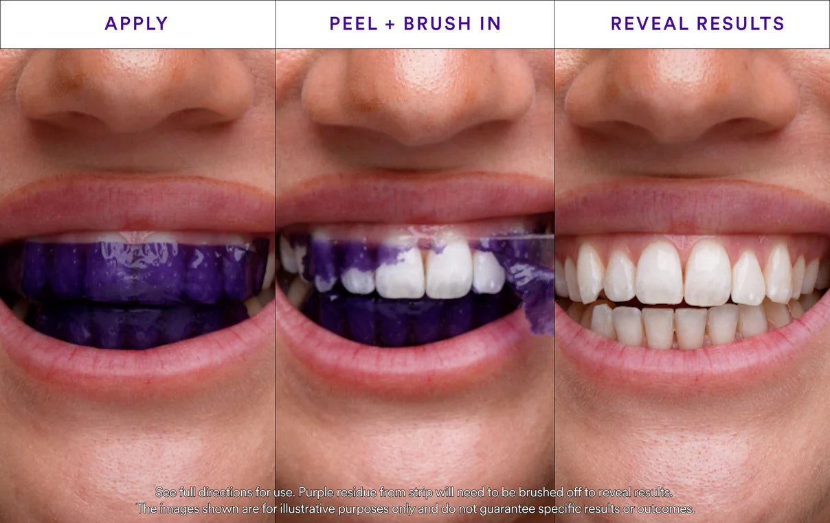 V34 Whitening Strips (7 Pack)