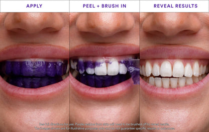 V34 Whitening Strips (7 Pack)